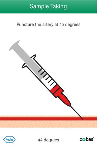 Blood Gas - Learn your ABGs