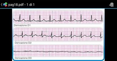 ECG fast APP
