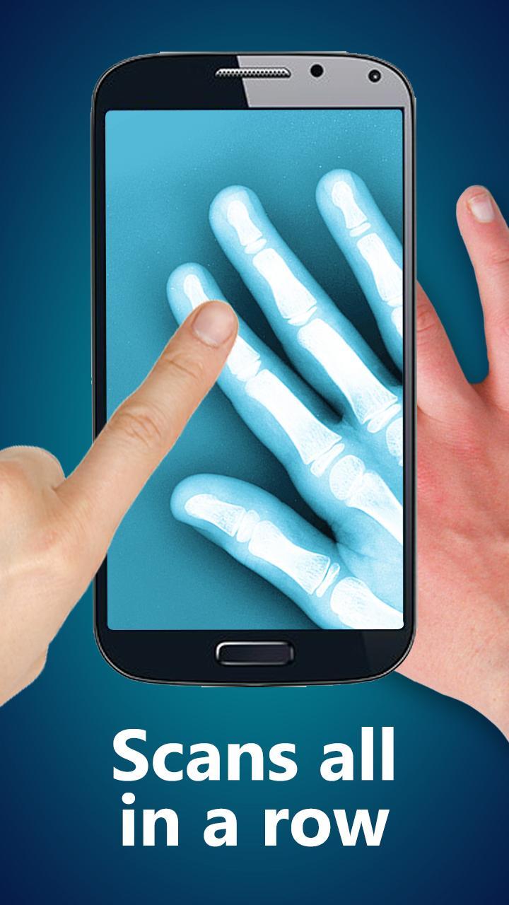 Xray Prank